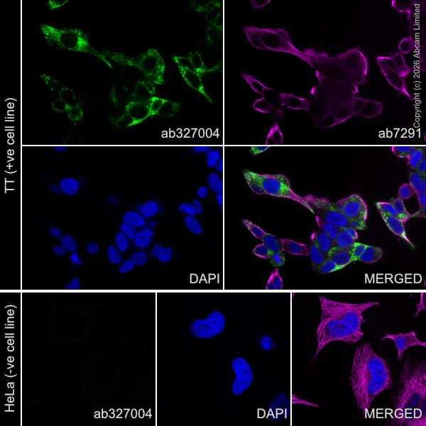 Immunocytochemistry/ Immunofluorescence - Anti-CGRP-I antibody [EPR29590-61] (AB327004)