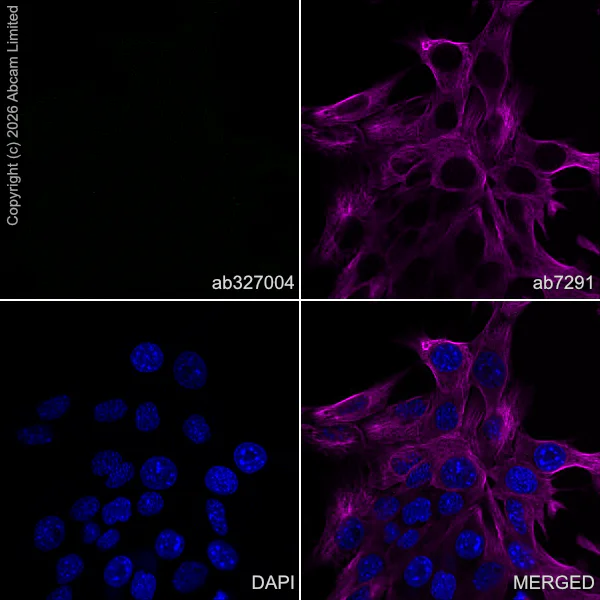 Immunocytochemistry/ Immunofluorescence - Anti-CGRP-I antibody [EPR29590-61] (AB327004)