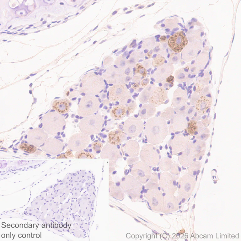 Immunohistochemistry (Formalin/PFA-fixed paraffin-embedded sections) - Anti-CGRP-I antibody [EPR29590-61] (AB327004)