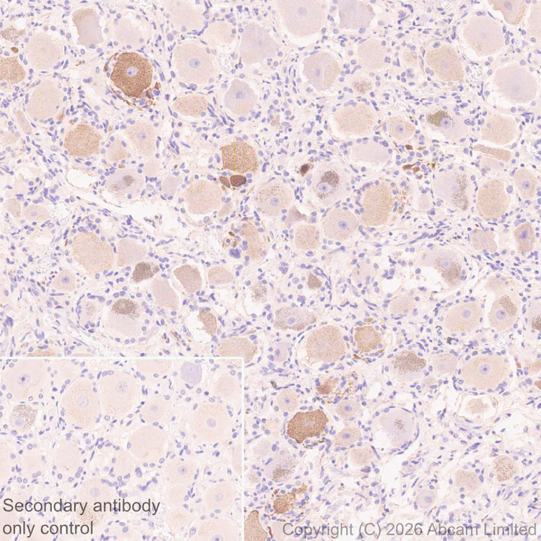 Immunohistochemistry (Formalin/PFA-fixed paraffin-embedded sections) - Anti-CGRP-I antibody [EPR29590-61] (AB327004)