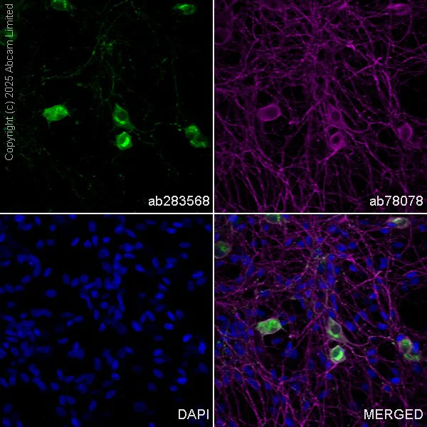 Immunocytochemistry/ Immunofluorescence - Anti-CGRP-I+CGRP-II antibody [EPR23804-95] (AB283568)