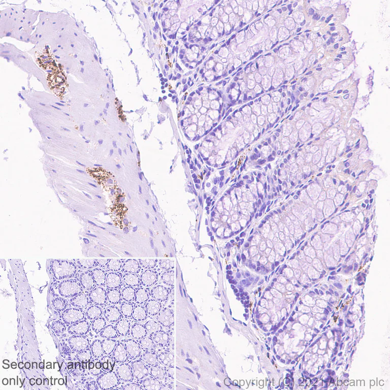 Immunohistochemistry (Formalin/PFA-fixed paraffin-embedded sections) - Anti-CGRP-I+CGRP-II antibody [EPR23804-95] (AB283568)