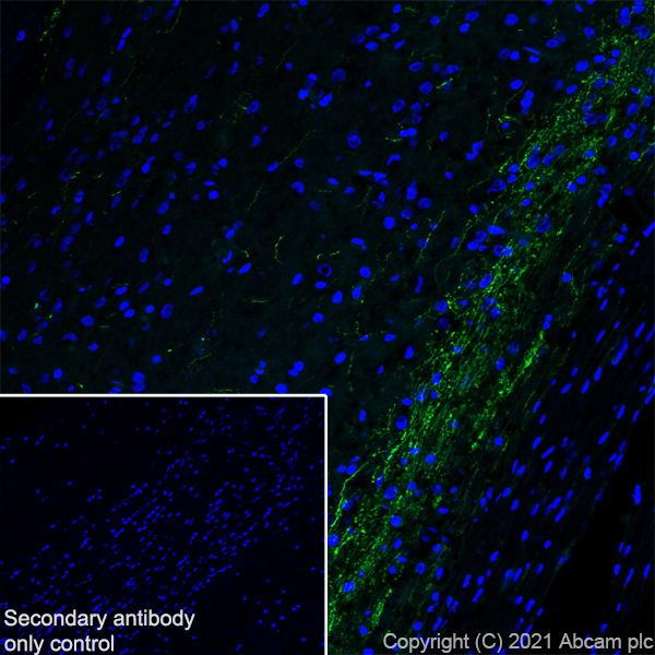 Immunohistochemistry (Frozen sections) - Anti-CGRP-I+CGRP-II antibody [EPR23804-95] - BSA and Azide free (ab283580), expandable thumbnail