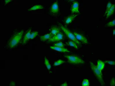 Immunocytochemistry/ Immunofluorescence - Anti-ch TOG antibody (AB236981)