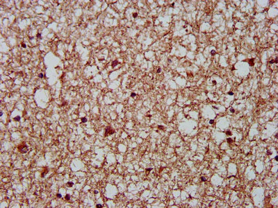 Immunohistochemistry (Formalin/PFA-fixed paraffin-embedded sections) - Anti-ch TOG antibody (AB236981)