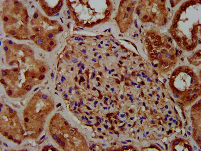 Immunohistochemistry (Formalin/PFA-fixed paraffin-embedded sections) - Anti-ch TOG antibody (AB236981)