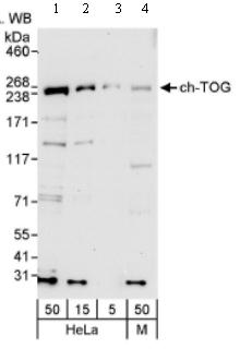 Western blot - Anti-ch TOG antibody (AB86073)