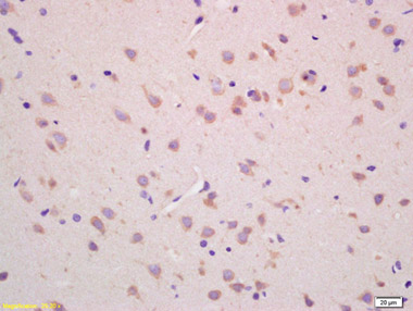 Immunohistochemistry (Formalin/PFA-fixed paraffin-embedded sections) - Anti-CHAC1 antibody (AB217808)