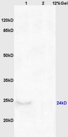 Western blot - Anti-CHAC1 antibody (AB217808)