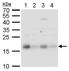 Western blot - Anti-CHAC2 antibody (AB183852)