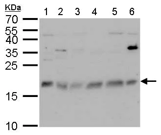 Western blot - Anti-CHAC2 antibody (AB183852)