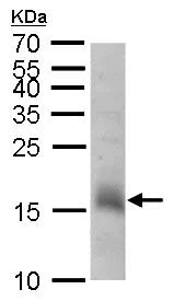 Western blot - Anti-CHAC2 antibody (AB183852)