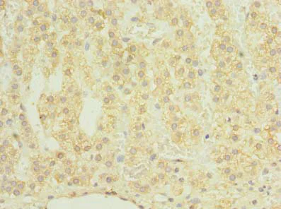Immunohistochemistry (Formalin/PFA-fixed paraffin-embedded sections) - Anti-CHAD antibody (AB238551)