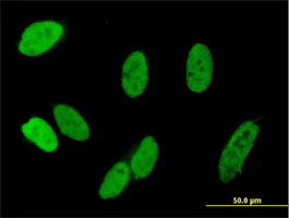 Immunocytochemistry/ Immunofluorescence - Anti-CHAMP antibody (AB169249)