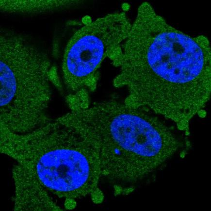 Immunocytochemistry/ Immunofluorescence - Anti-CHCH antibody (AB243505), expandable thumbnail