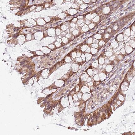 Immunohistochemistry (Formalin/PFA-fixed paraffin-embedded sections) - Anti-CHCH antibody (AB243505), expandable thumbnail