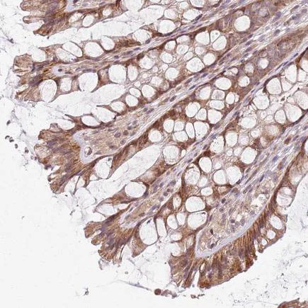 Immunohistochemistry (Formalin/PFA-fixed paraffin-embedded sections) - Anti-CHCH antibody (AB243505)