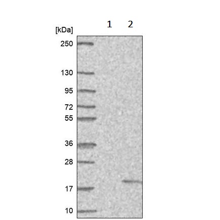 Western blot - Anti-CHCH antibody (AB243505), expandable thumbnail