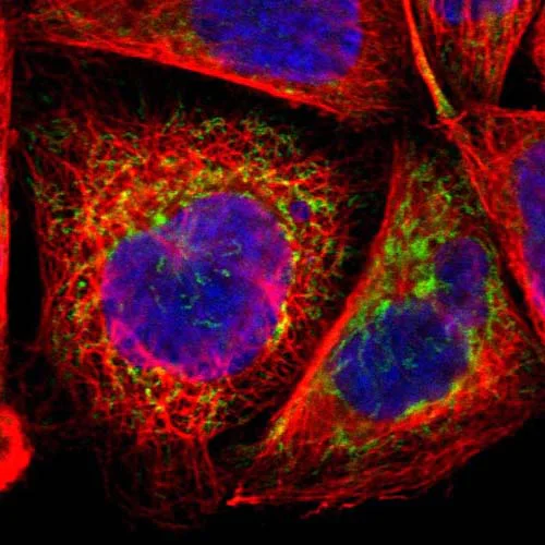 Immunocytochemistry/ Immunofluorescence - Anti-CHCHD10 antibody (AB121196)