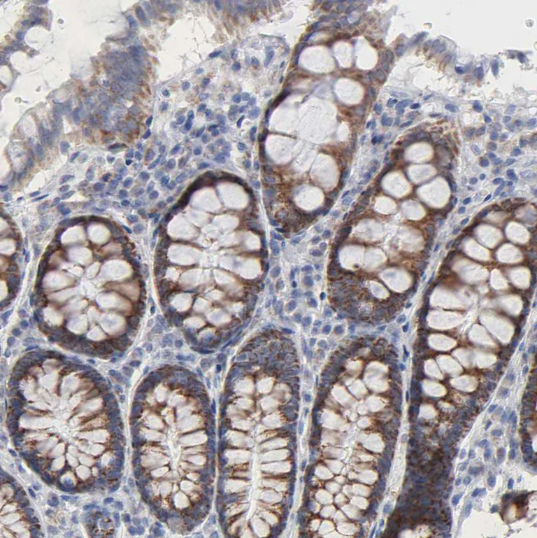 Immunohistochemistry (Formalin/PFA-fixed paraffin-embedded sections) - Anti-CHCHD10 antibody (AB121196)