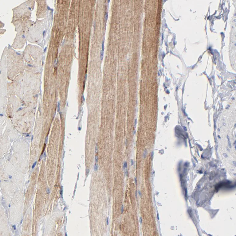 Immunohistochemistry (Formalin/PFA-fixed paraffin-embedded sections) - Anti-CHCHD10 antibody (AB121196)