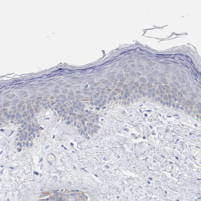 Immunohistochemistry (Formalin/PFA-fixed paraffin-embedded sections) - Anti-CHCHD10 antibody (AB121196)