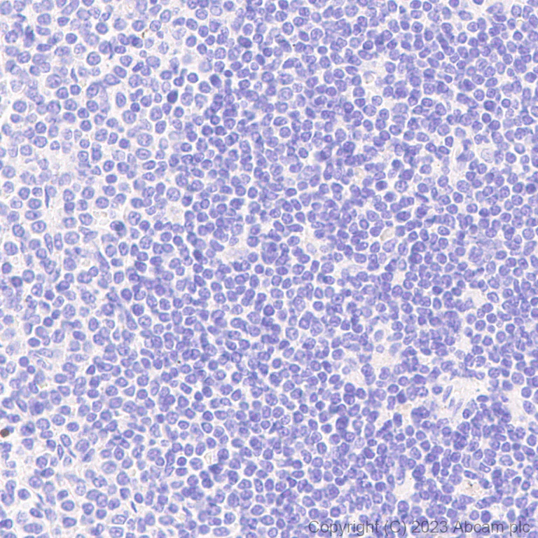 Immunohistochemistry (Formalin/PFA-fixed paraffin-embedded sections) - Anti-CHCHD10 antibody [EPR26966-33] (AB308510)