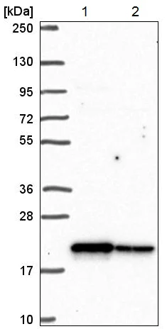 Western blot - Anti-CHCHD2 antibody (AB220688)