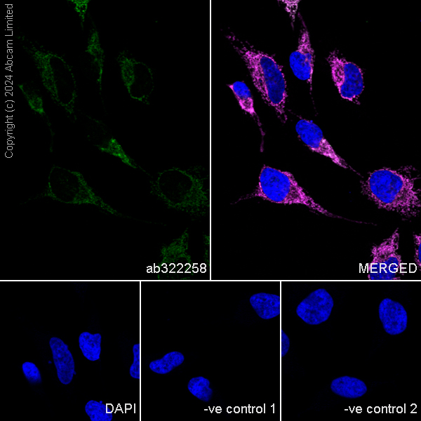 Immunocytochemistry/ Immunofluorescence - Anti-CHCHD2 antibody [EPR29117-175] (AB322258), expandable thumbnail