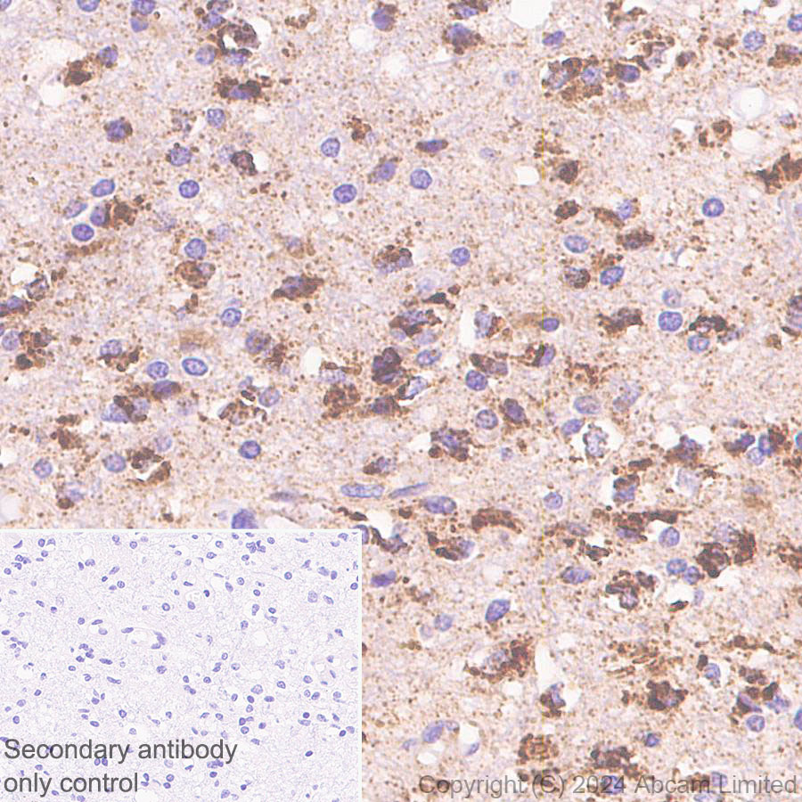 Immunohistochemistry (Formalin/PFA-fixed paraffin-embedded sections) - Anti-CHCHD2 antibody [EPR29117-175] (ab322258), expandable thumbnail