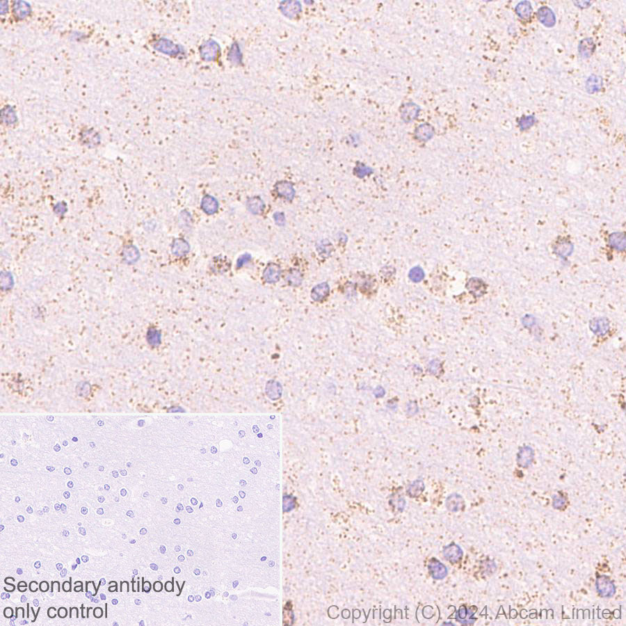 Immunohistochemistry (Formalin/PFA-fixed paraffin-embedded sections) - Anti-CHCHD2 antibody [EPR29117-175] (ab322258), expandable thumbnail