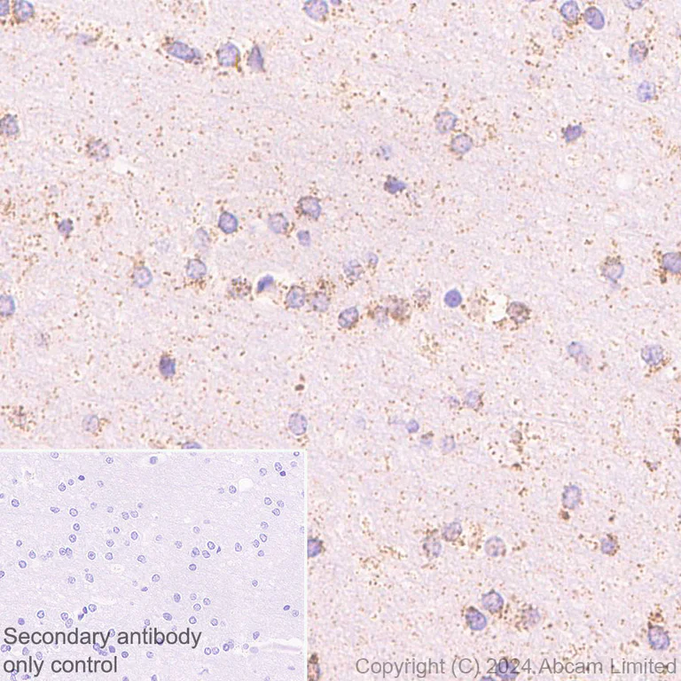 Immunohistochemistry (Formalin/PFA-fixed paraffin-embedded sections) - Anti-CHCHD2 antibody [EPR29117-175] (AB322258)