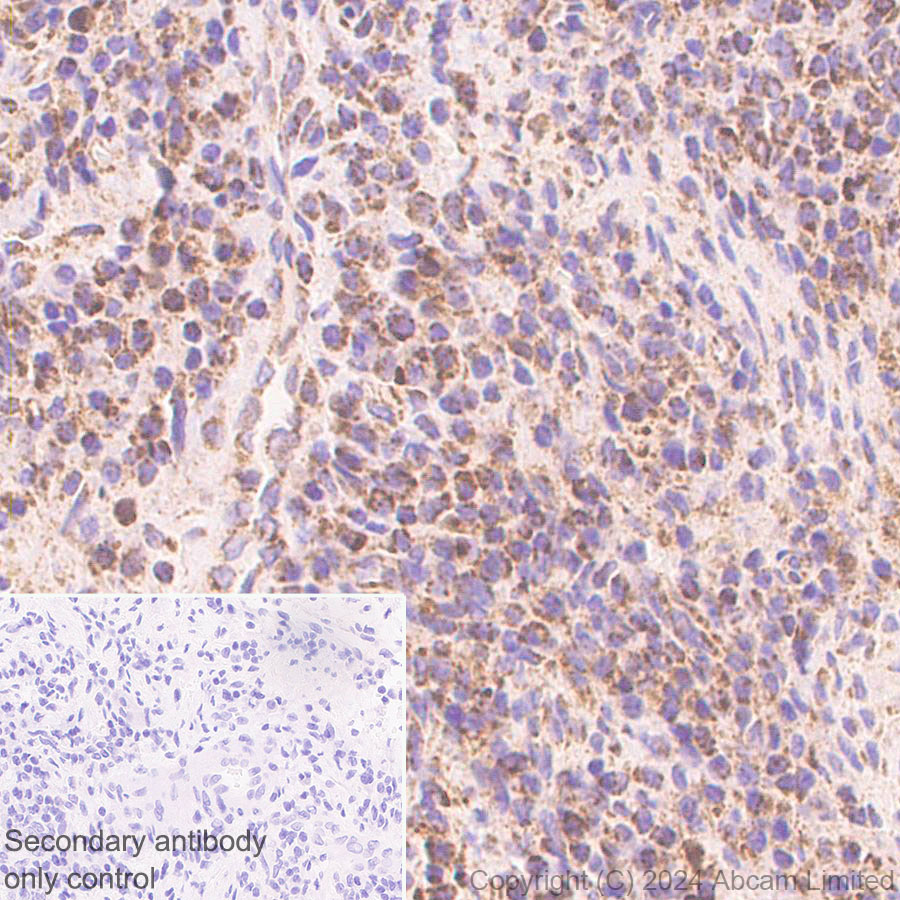 Immunohistochemistry (Formalin/PFA-fixed paraffin-embedded sections) - Anti-CHCHD2 antibody [EPR29117-175] (ab322258), expandable thumbnail