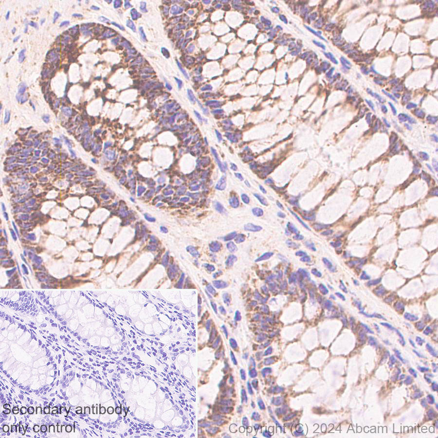 Immunohistochemistry (Formalin/PFA-fixed paraffin-embedded sections) - Anti-CHCHD2 antibody [EPR29117-175] (ab322258), expandable thumbnail