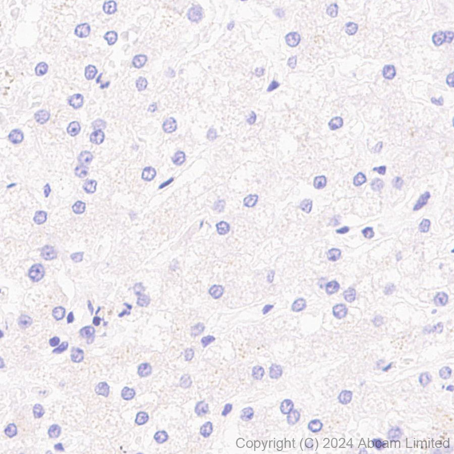 Immunohistochemistry (Formalin/PFA-fixed paraffin-embedded sections) - Anti-CHCHD2 antibody [EPR29117-175] (AB322258), expandable thumbnail