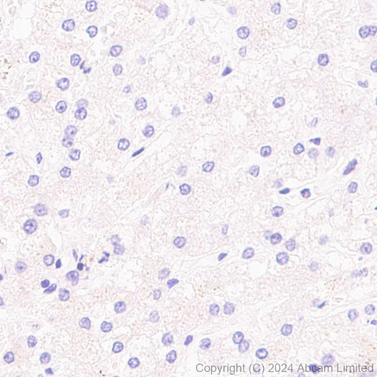 Immunohistochemistry (Formalin/PFA-fixed paraffin-embedded sections) - Anti-CHCHD2 antibody [EPR29117-175] (AB322258)