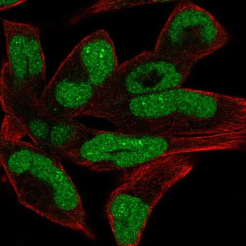 Immunocytochemistry/ Immunofluorescence - Anti-Chd1 antibody (AB244391)