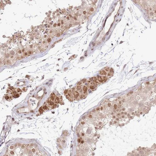 Immunohistochemistry (Formalin/PFA-fixed paraffin-embedded sections) - Anti-Chd1 antibody (AB244391)