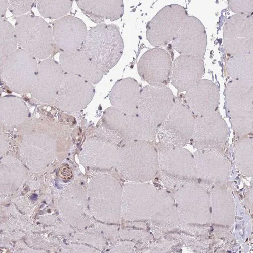 Immunohistochemistry (Formalin/PFA-fixed paraffin-embedded sections) - Anti-Chd1 antibody (AB244391)