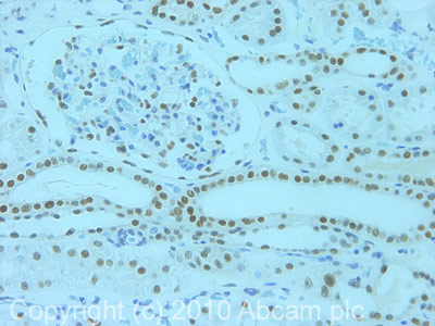 Immunohistochemistry (Formalin/PFA-fixed paraffin-embedded sections) - Anti-CHD1L antibody [2170C3a] (AB51324)