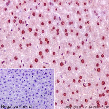Immunohistochemistry (Formalin/PFA-fixed paraffin-embedded sections) - Anti-CHD1L antibody [EPR14515(2)] (AB197019), expandable thumbnail