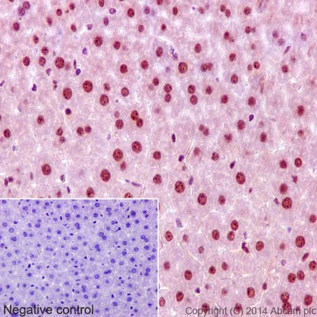 Immunohistochemistry (Formalin/PFA-fixed paraffin-embedded sections) - Anti-CHD1L antibody [EPR14515(2)] (AB197019)