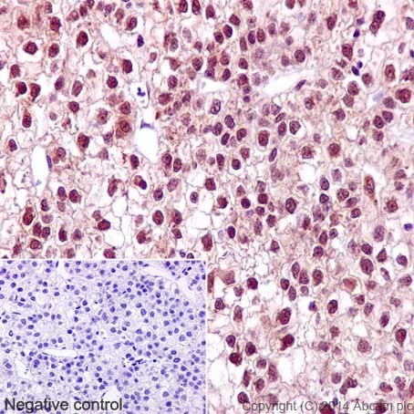 Immunohistochemistry (Formalin/PFA-fixed paraffin-embedded sections) - Anti-CHD1L antibody [EPR14515(2)] (AB197019), expandable thumbnail