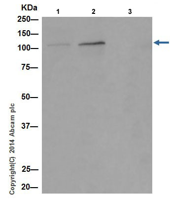 Immunoprecipitation - Anti-CHD1L antibody [EPR14515(2)] (AB197019), expandable thumbnail