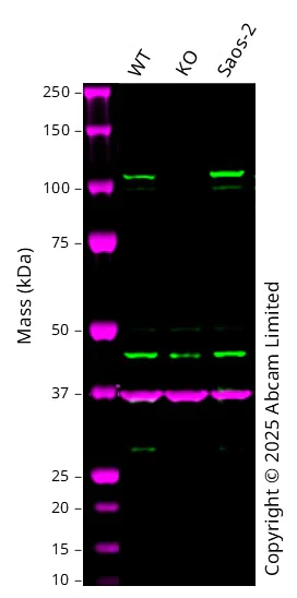 Western blot - Anti-CHD1L antibody [EPR14515(2)] (AB197019)