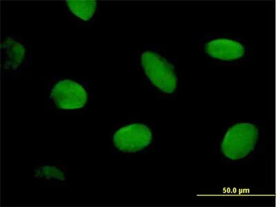 Immunocytochemistry/ Immunofluorescence - Anti-CHD2 antibody (AB167377)