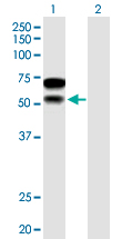 Western blot - Anti-CHD2 antibody (AB167377)