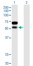 Western blot - Anti-CHD2 antibody (AB167377)