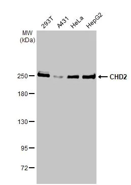 Western blot - Anti-CHD2 antibody [HL2066] (AB308222)