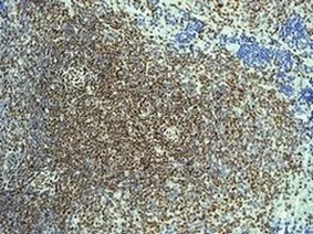 Immunohistochemistry (Formalin/PFA-fixed paraffin-embedded sections) - Anti-CHD3 antibody [EPNCIR110] (AB134125)